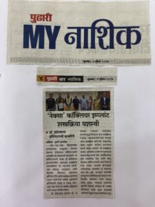 Nexa cochlear implant device used during surgery in Nashik ENT hospital